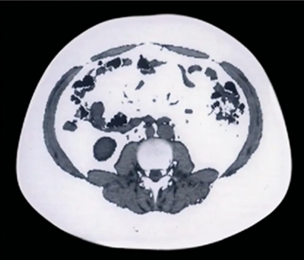 Chiropractic South Sioux City NE Fat Belly Cross Section