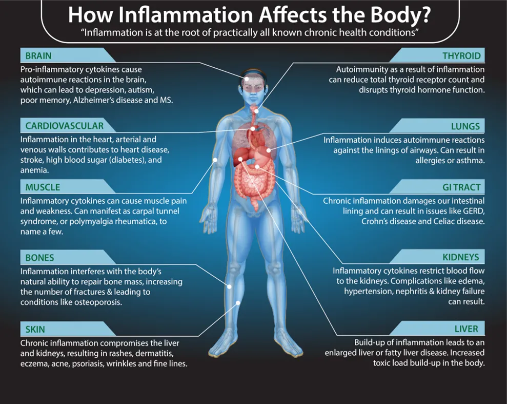 Chiropractic South Sioux City NE Inflammation Affects Body