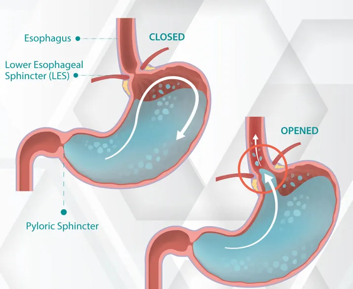 Chiropractic South Sioux City NE Stomach